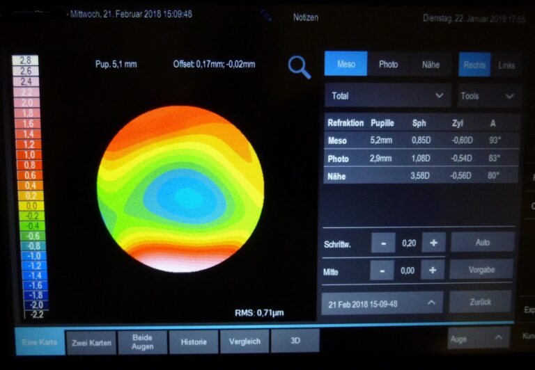 Optiker GöDoSchaust - Wien Meidling - Rodenstock DNEye Scanner